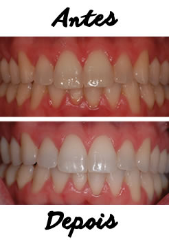 Tratamento dentário Tratamento dentário