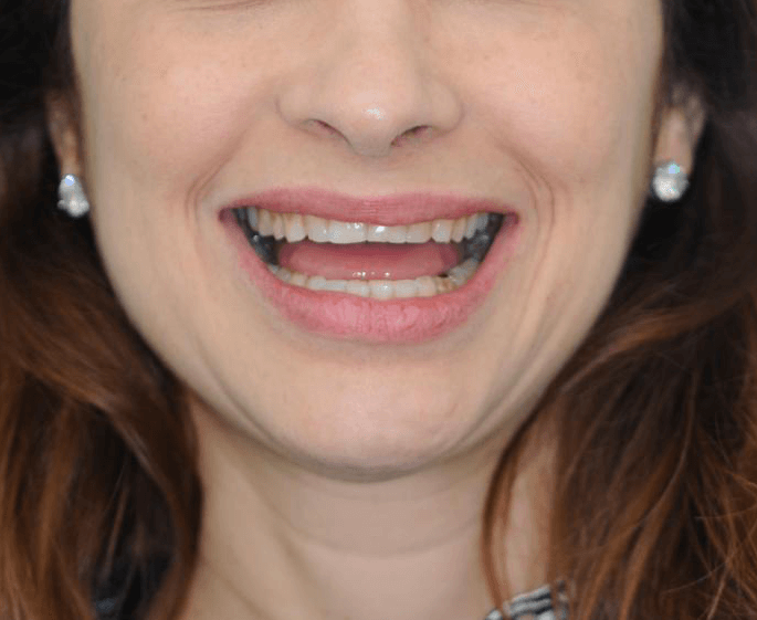 foto1 Simulação do Sorriso - Dentista em Niterói