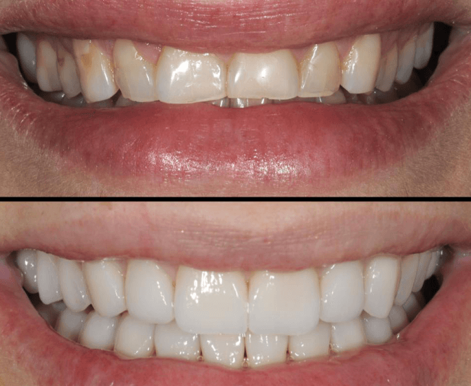 foto3 Simulação do Sorriso - Dentista em Niterói