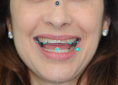 software-smile-pro